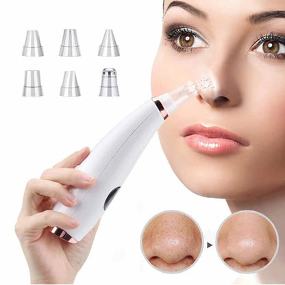 Electric Blackhead Deep Cleansing