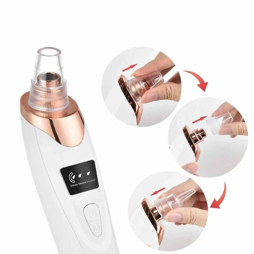 Electric Blackhead Removal Vacuum