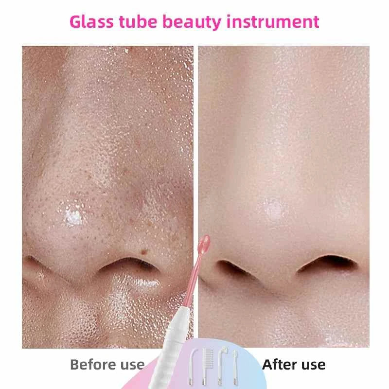 High-Frequency Skin Care Wand